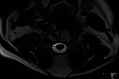 Fig. 13.
