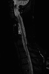 Fig. 12.