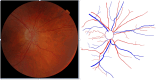 Fig. 1