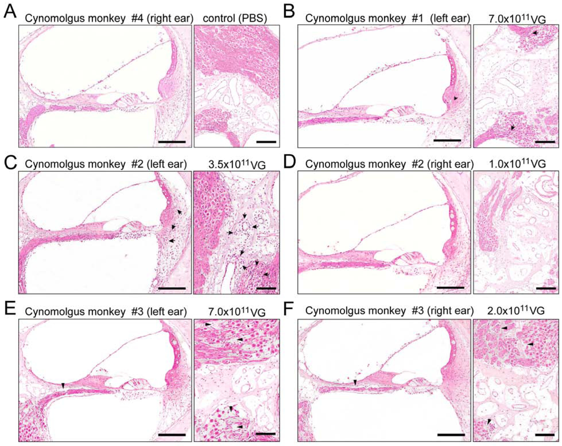 Fig 4.