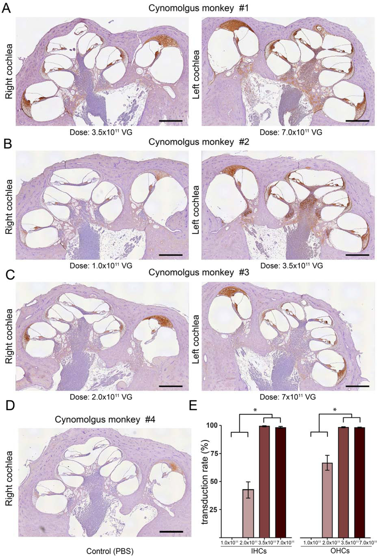 Preclinical testing of AAV9-PHP.B for transgene expression in the non ...