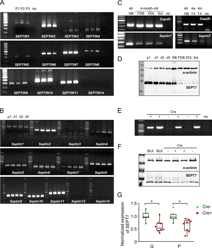 Figure 1—figure supplement 1.