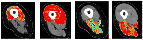 Fig 3.