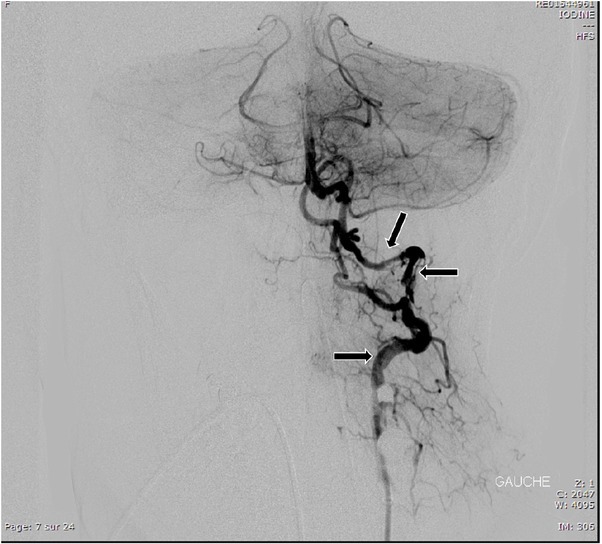 Fig. 4