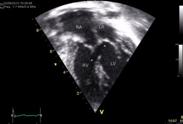 Fig. 5