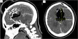 Fig. 4 –