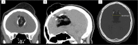 Fig. 1 –
