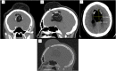 Fig. 2 –