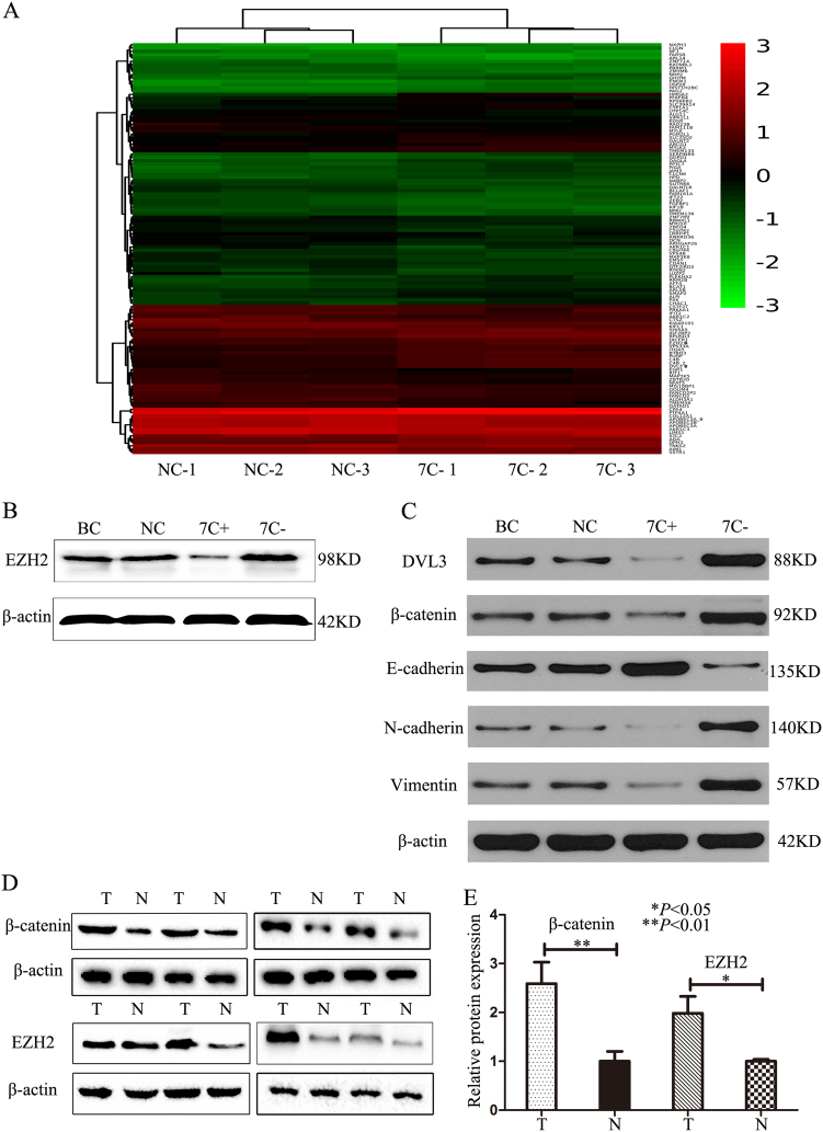 Let-7c inhibits cholangiocarcinoma growth but promotes tumor cell ...