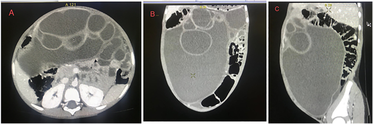 Fig. 1