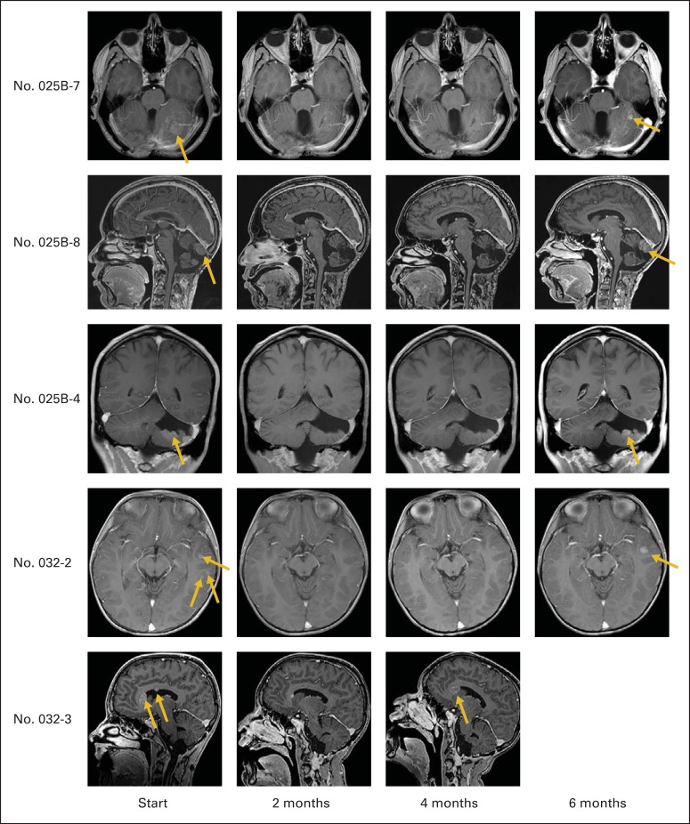 Fig 4.