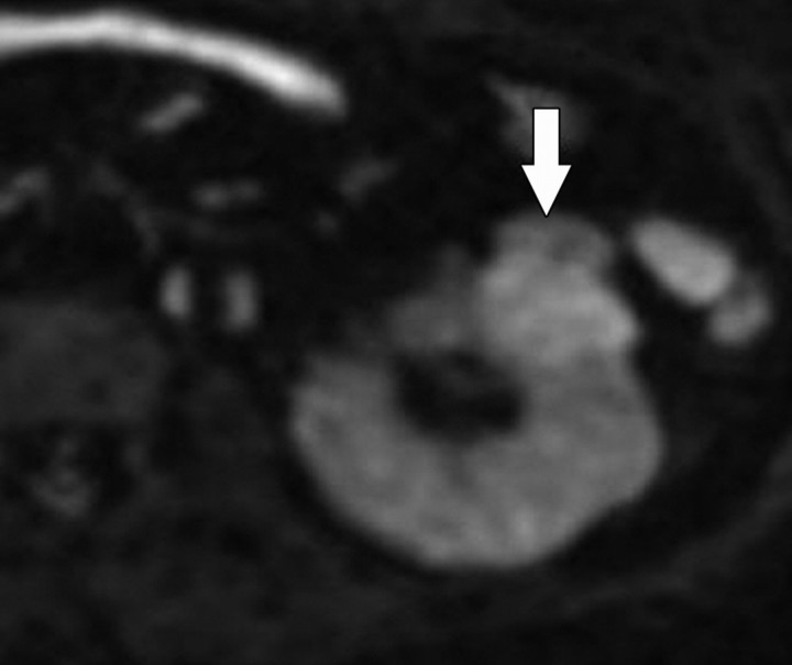 Figure 11b