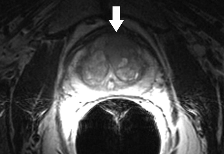 Figure 10a