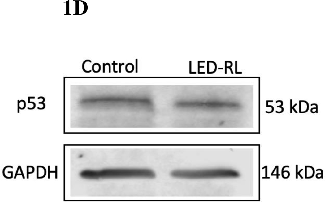 Figure 1A