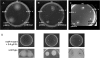 FIG. 4.