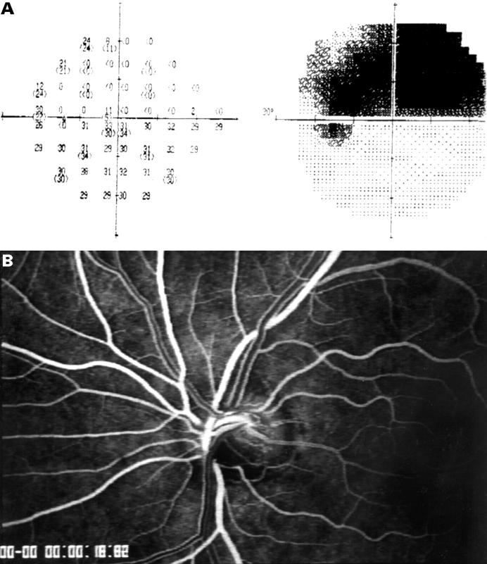 Figure 2  