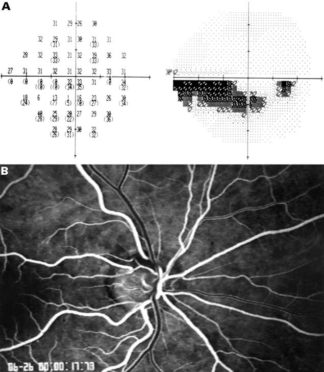 Figure 1  