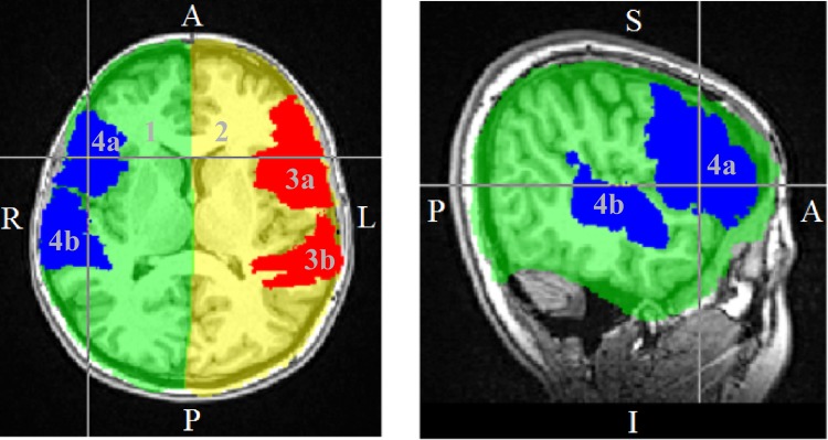 Fig 1