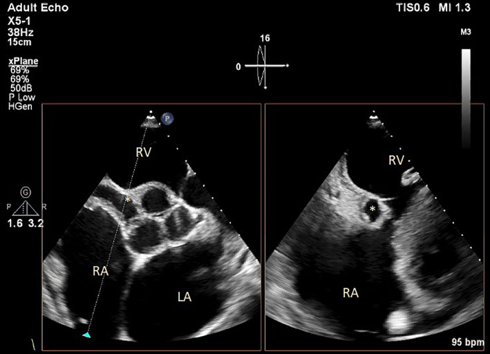 FIGURE 3