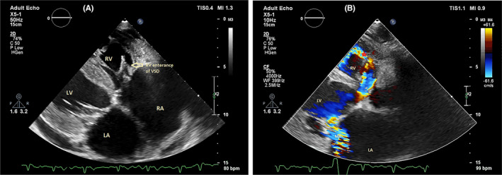 FIGURE 4