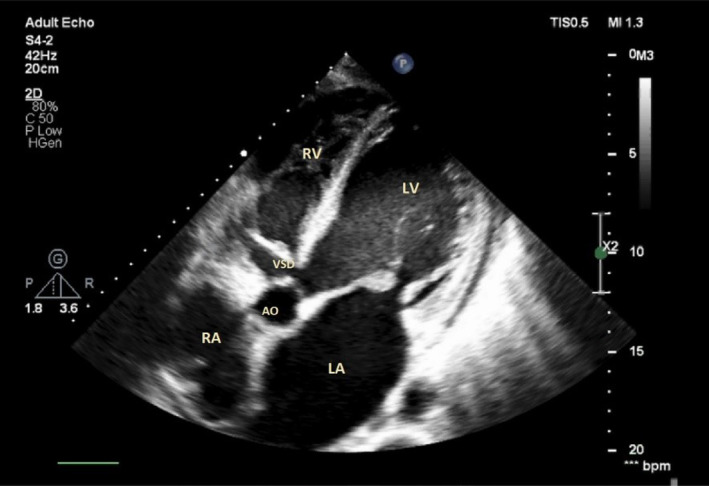 FIGURE 1