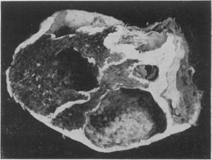 Fig. 13