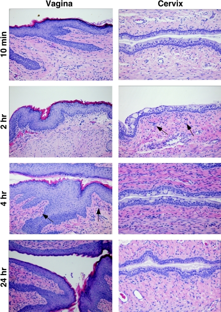 FIG. 4.