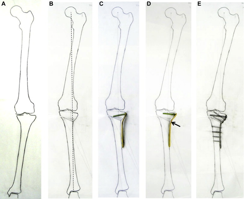 Fig 1