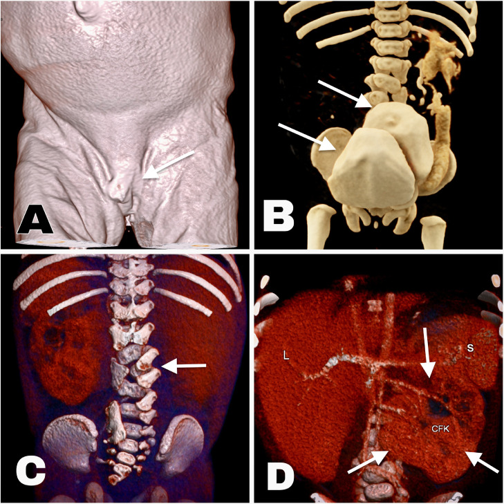 Fig 1