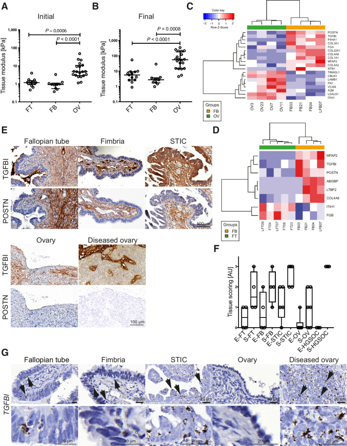 Figure 1. Identification of tissue modulus and matrisome proteins that define tissue architecture of human OV and FT tissues. A and B, Initial and final tissue modulus of human FT, FB, and OV tissues. Statistical significance was determined using Kruskal–Wallis test with Dunn multiple comparison test. C and D, Heatmap depicting matrisome proteins differentially expressed between OV (n = 4), FB (n = 4), FT (n = 5), and FB tissues. E, IHC of TGFBI and POSTN. Representative images from FT (n = 4), FB (n = 4), STIC (n = 7), ovary (n = 6), and diseased ovary (n = 3) tissues. F, Modified Allred scoring of the matrisome protein TGFBI. Scoring describes the percentage of positive staining (0 = negative, 1 = weak, 2 = moderate, 3 = strong). Scoring was performed on epithelial (E) and stromal (S) areas of FT (n = 4), FB (n = 4), STIC (n = 5), ovary (n = 6), and diseased ovary (n = 3) tissues. G, ISH of TGFBI in healthy and diseased FT and OV tissues. Arrows indicate cells with a high copy number of TGFBI mRNA and cytoplasmic projections. Representative images of FT (n = 3), FB (n = 3), STIC (n = 9), ovary (n = 4), and invasive HGSOC at the ovary (n = 6).