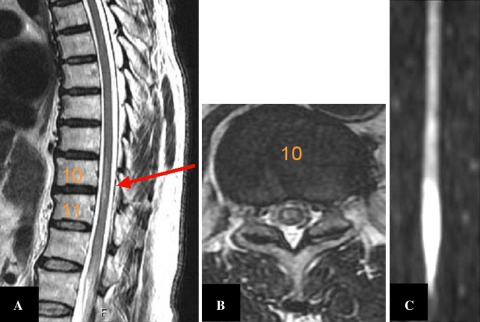 Fig. 1