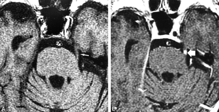 fig 1.