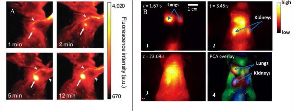 Figure 11