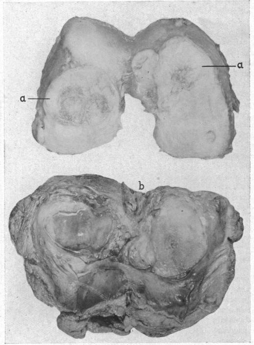 FIG. 5.