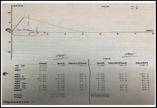 Fig.1