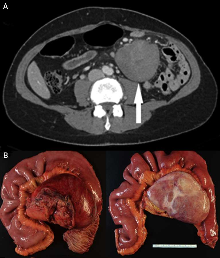 Figure 2