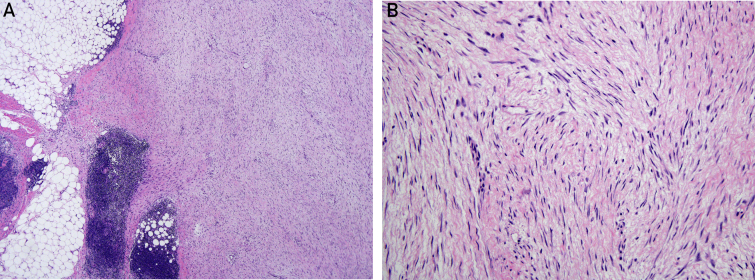 Figure 5