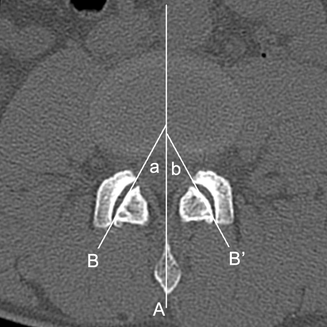 Fig. 1