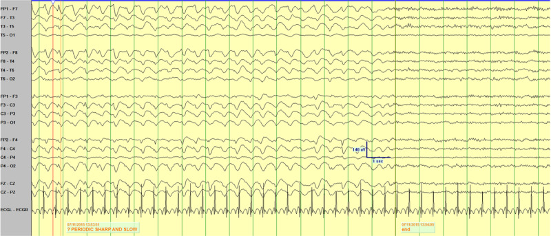 Figure 2B