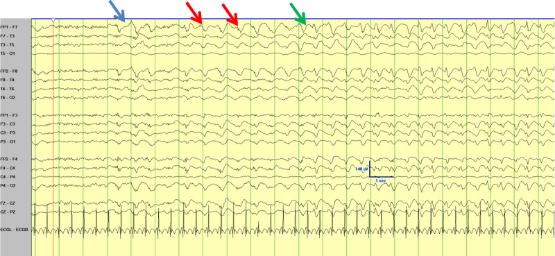 Figure 2A