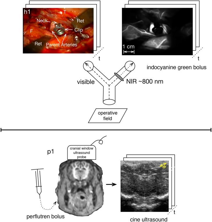 Fig 1