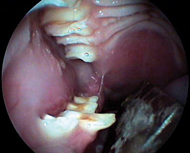 Figure 14-14