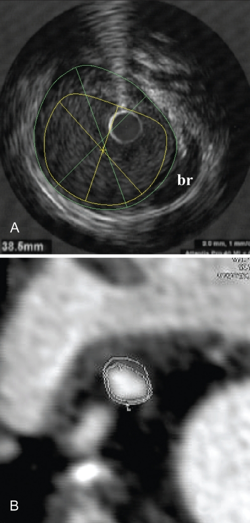 Figure 3)