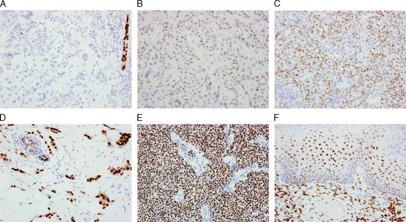 Immunohistochemical Performance of Estrogen and Progesterone Receptor ...