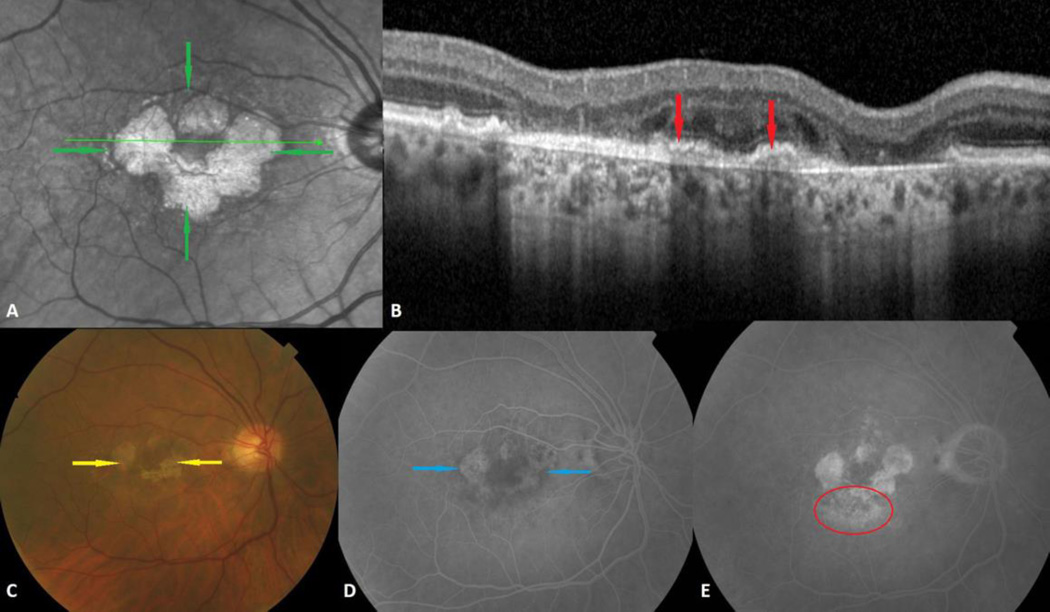 Fig. 1