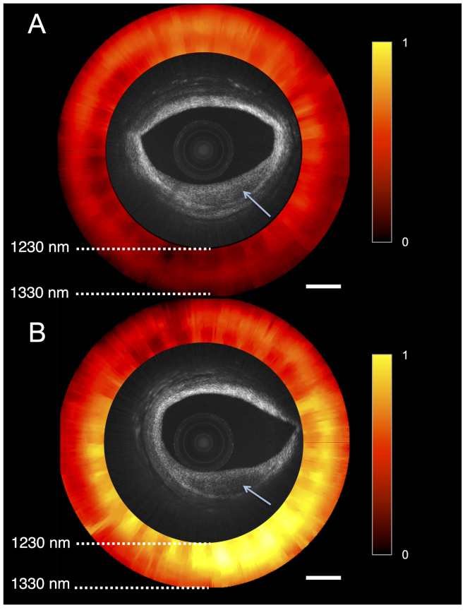 Fig. 4