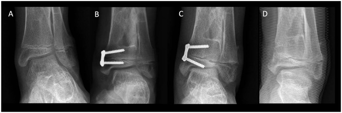 Fig. 2