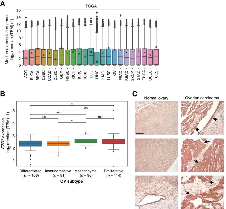 Figure 1. FZD7 RNA and protein expression are elevated in ovarian carcinomas. A, Median FZD7 expression in TCGA RNA-seq by cancer type. Data points indicate individual genes; box plots indicate 75% of surveyed genes; X's on box plots indicate FZD7 expression. B, Median FZD7 expression in TCGA OV subtypes defined by CLOVAR. Data points indicate individual patient samples; box plots indicate 75% of surveyed patient samples. For statistical analyses: two-sided Mann–Whitney–Wilcoxon test with Bonferroni correction; ****, P ≤ 0.0001; **, P ≤ 0.01; ns, not significant. C, FZD7 expression is low in normal ovarian tissues but elevated in ovarian carcinomas. Tissues shown at 100× magnification; red-brown staining and arrows: FZD7 staining; scale bar, 500 μm.