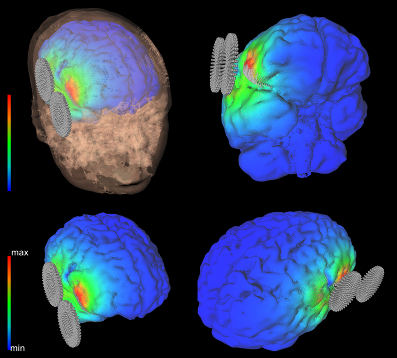 Figure 2.