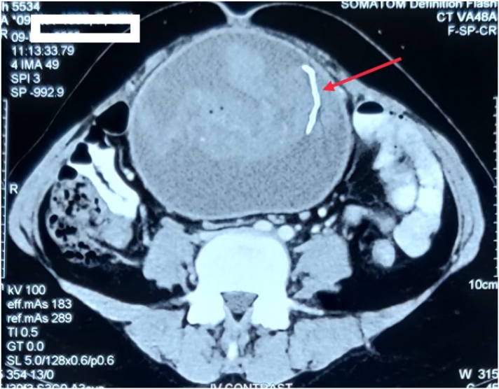 Fig. 2